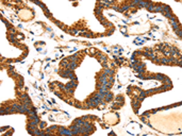 Anti-SLC25A26 Rabbit Polyclonal Antibody