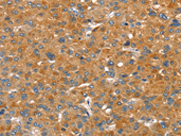 Anti-SLC29A4 Rabbit Polyclonal Antibody
