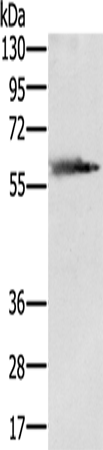 Anti-SLC29A4 Rabbit Polyclonal Antibody
