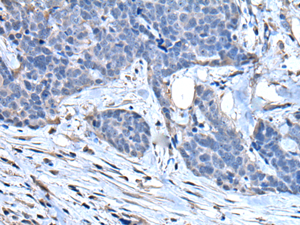 Anti-SLPI Rabbit Polyclonal Antibody