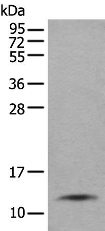 Anti-SLPI Rabbit Polyclonal Antibody