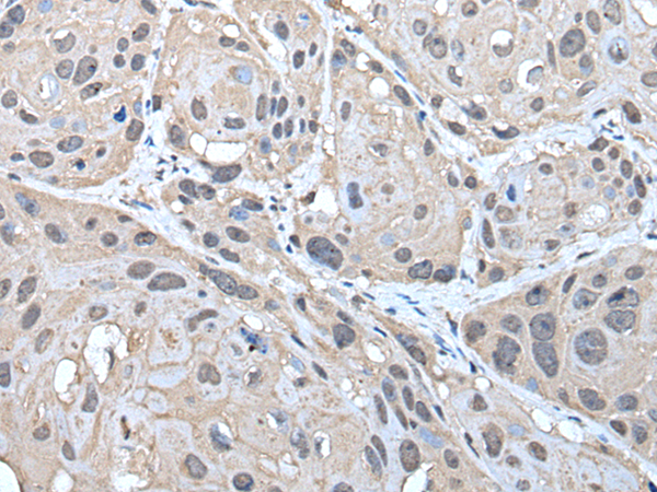 Anti-HELLS Rabbit Polyclonal Antibody
