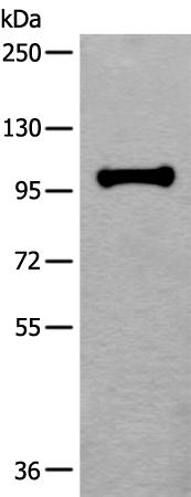 Anti-HELLS Rabbit Polyclonal Antibody