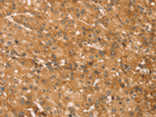 Anti-SNAP29 Rabbit Polyclonal Antibody