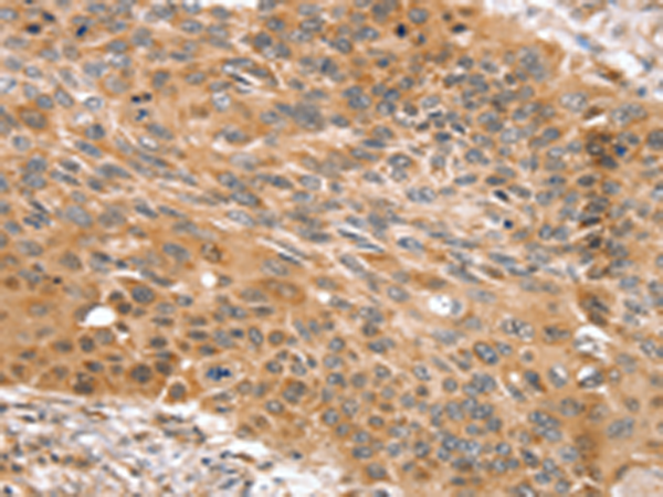 Anti-SNX11 Rabbit Polyclonal Antibody