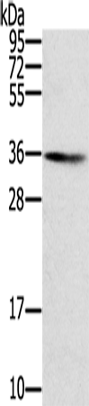 Anti-SNX11 Rabbit Polyclonal Antibody
