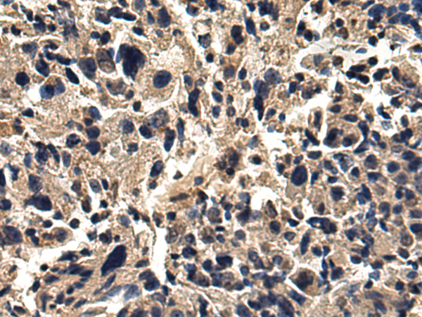 Anti-Sprouty 2 Rabbit Polyclonal Antibody
