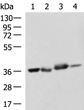 Anti-Sprouty 2 Rabbit Polyclonal Antibody