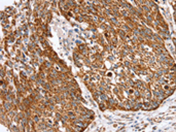 Anti-SSBP1 Rabbit Polyclonal Antibody