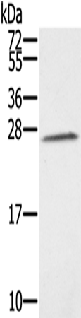 Anti-SSX1 Rabbit Polyclonal Antibody