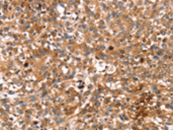 Anti-StAR Rabbit Polyclonal Antibody