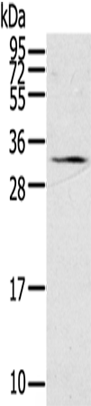 Anti-StAR Rabbit Polyclonal Antibody