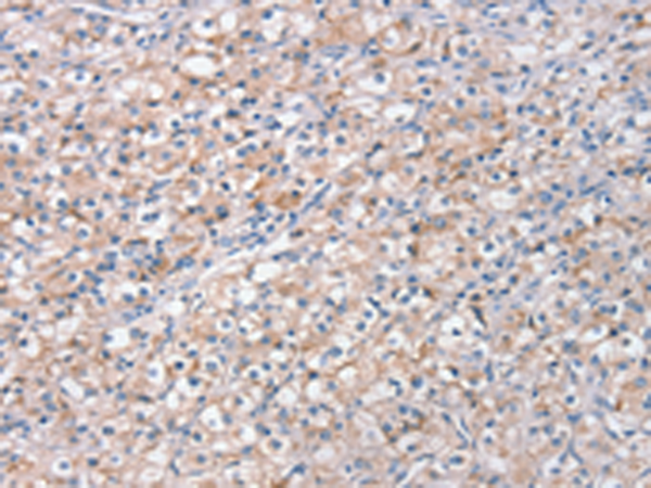 Anti-STK16 Rabbit Polyclonal Antibody