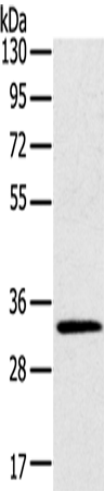 Anti-STK16 Rabbit Polyclonal Antibody