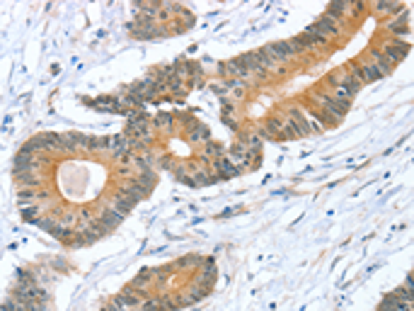 Anti-STXBP1 Rabbit Polyclonal Antibody