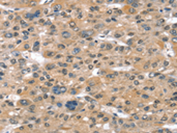Anti-Sulfotransferase 1B1 Rabbit Polyclonal Antibody