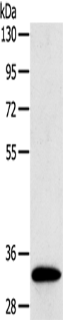 Anti-Sulfotransferase 1B1 Rabbit Polyclonal Antibody