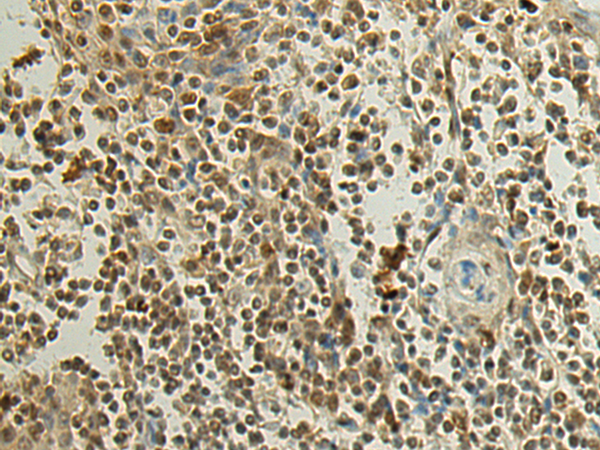Anti-Surfeit Locus Protein 6 Rabbit Polyclonal Antibody