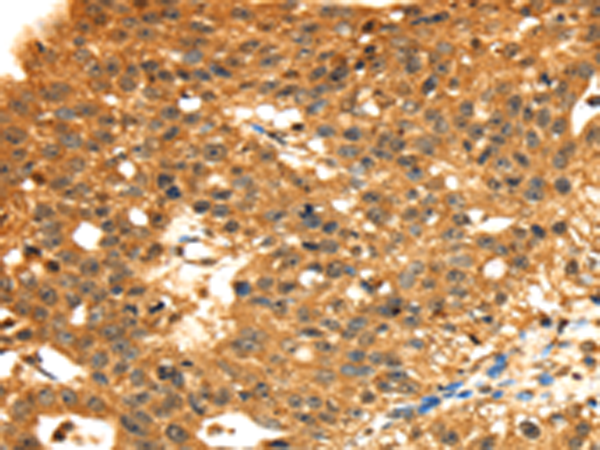 Anti-STX8 Rabbit Polyclonal Antibody