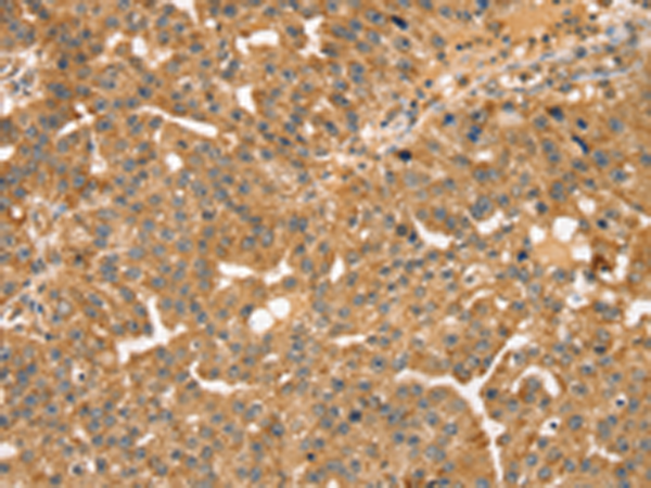 Anti-STX10 Rabbit Polyclonal Antibody