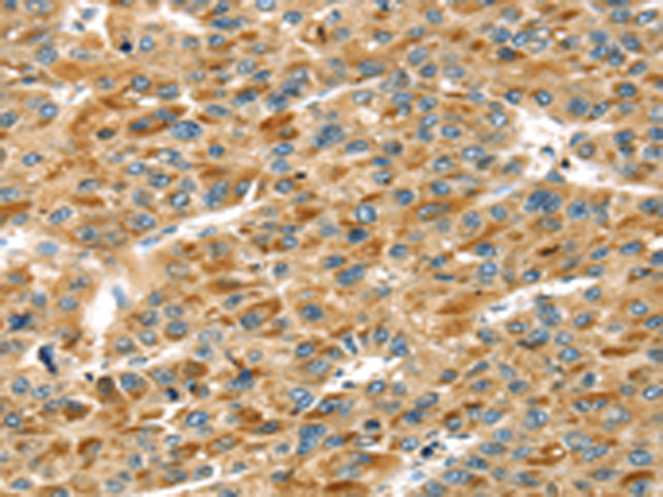 Anti-STX11 Rabbit Polyclonal Antibody