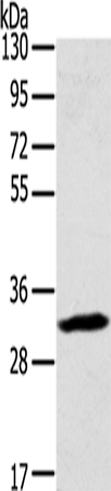 Anti-STX11 Rabbit Polyclonal Antibody