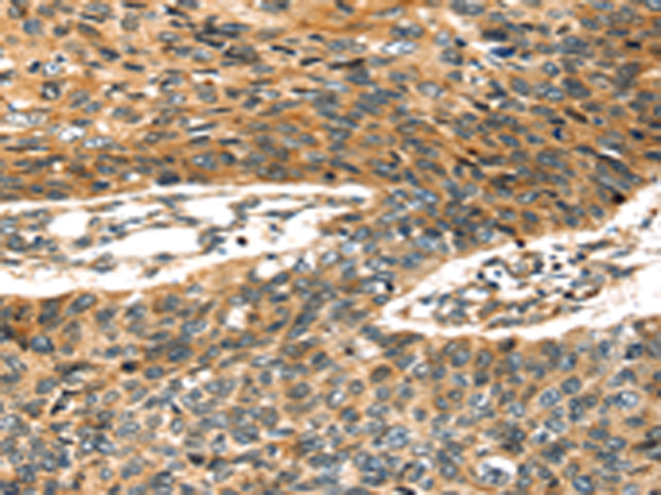 Anti-STX19 Rabbit Polyclonal Antibody