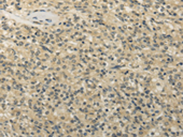 Anti-TBC1 Domain Family Member 22A Rabbit Polyclonal Antibody