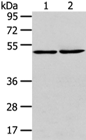 Anti-TBC1 Domain Family Member 22A Rabbit Polyclonal Antibody