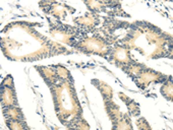 Anti-RASD2 Rabbit Polyclonal Antibody