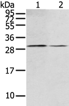 Anti-RASD2 Rabbit Polyclonal Antibody