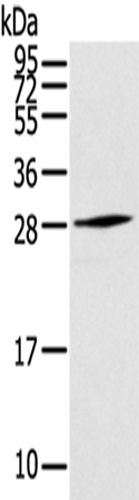 Anti-Thymocyte nuclear protein 1 Rabbit Polyclonal Antibody