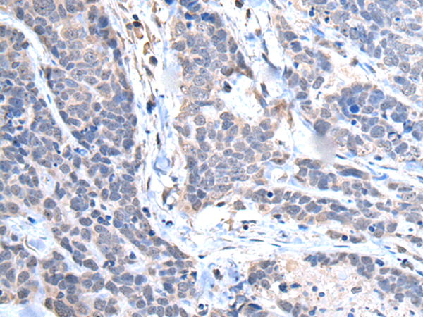 Anti-TRIM27 Rabbit Polyclonal Antibody