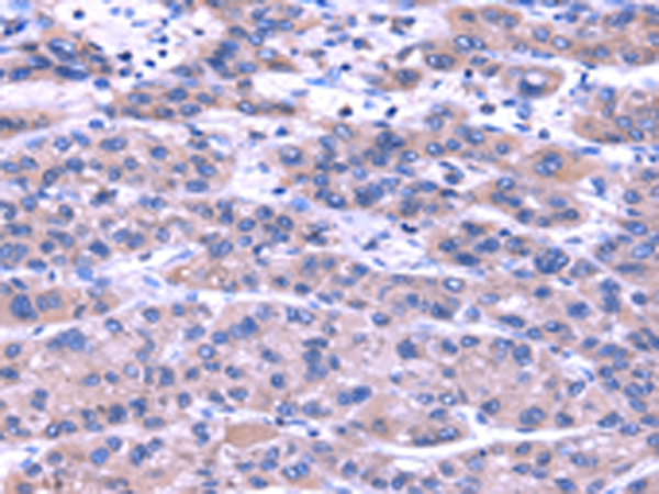 Anti-TRIM49 Rabbit Polyclonal Antibody