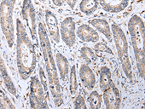 Anti-TIMM17A Rabbit Polyclonal Antibody