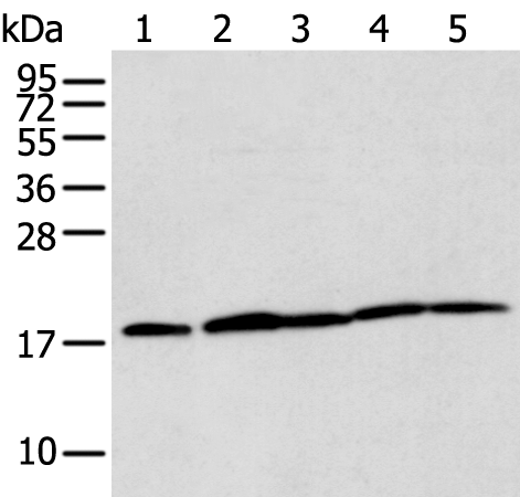 Anti-TIMM17A Rabbit Polyclonal Antibody