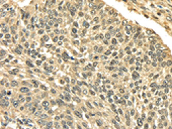 Anti-PLIN3 Rabbit Polyclonal Antibody