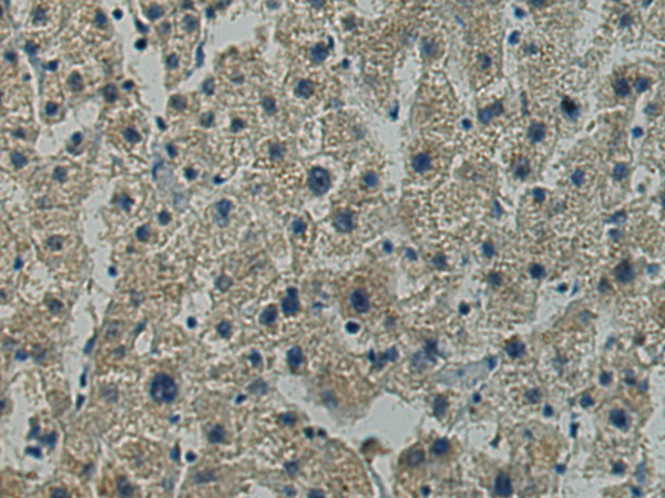 Anti-TLK2 Rabbit Polyclonal Antibody
