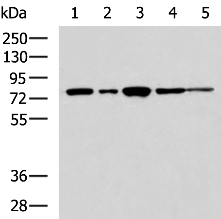 Anti-TLK2 Rabbit Polyclonal Antibody