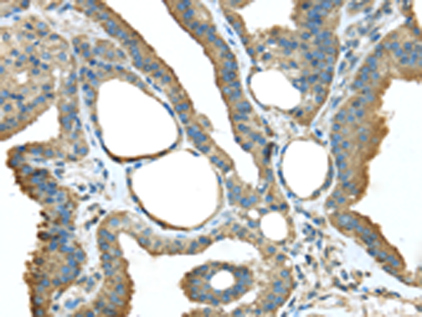 Anti-TMED1 Rabbit Polyclonal Antibody