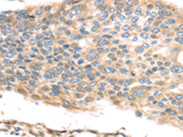 Anti-TMED2 Rabbit Polyclonal Antibody