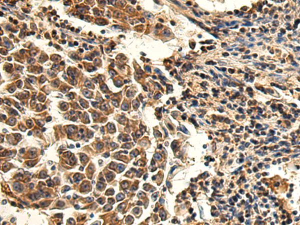 Anti-TMED4 Rabbit Polyclonal Antibody