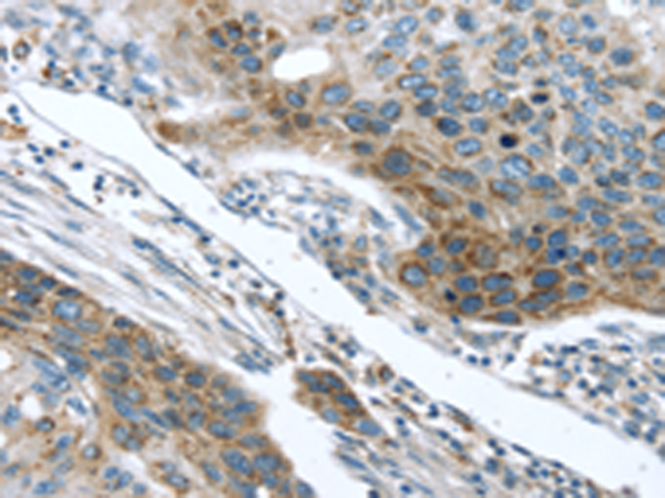 Anti-Transmembrane Protease Serine 5 Rabbit Polyclonal Antibody