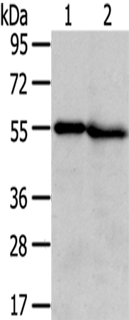 Anti-Transmembrane Protease Serine 5 Rabbit Polyclonal Antibody