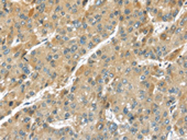Anti-Transmembrane Protease Serine 11D Rabbit Polyclonal Antibody