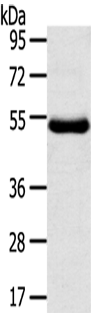 Anti-Transmembrane Protease Serine 11D Rabbit Polyclonal Antibody