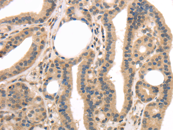 Anti-TPSB2 Rabbit Polyclonal Antibody