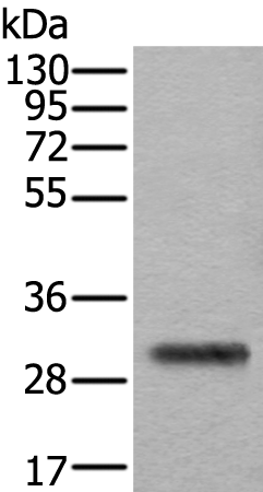 Anti-TPSB2 Rabbit Polyclonal Antibody