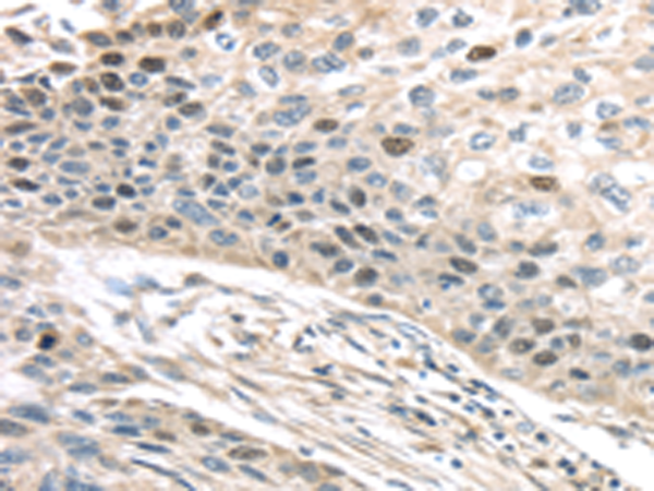Anti-TPX2 Rabbit Polyclonal Antibody
