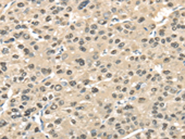 Anti-Transaldolase Rabbit Polyclonal Antibody